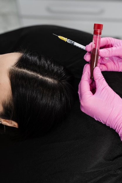 Plasma Rico em Plaquetas PRP para melhora o volume e a textura da pele reduz flacidez e rugas finas Cosmetologista com tubo de ensaio com plasma de paciente menina para procedimento de Plasma Rico em Plaquetas PRP