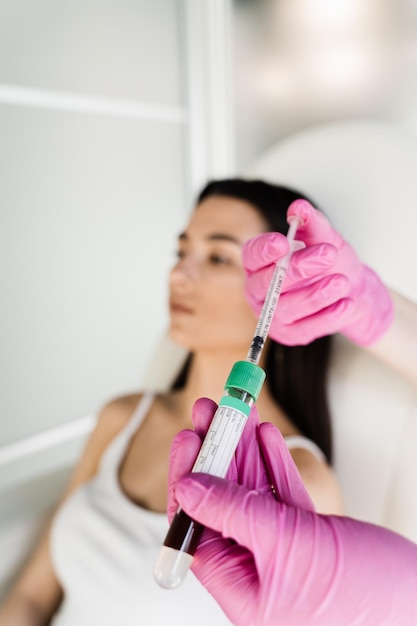 Plasma Rico em Plaquetas PRP para melhora o volume e a textura da pele reduz flacidez e rugas finas Cosmetologista com tubo de ensaio com plasma de paciente menina para procedimento de Plasma Rico em Plaquetas PRP