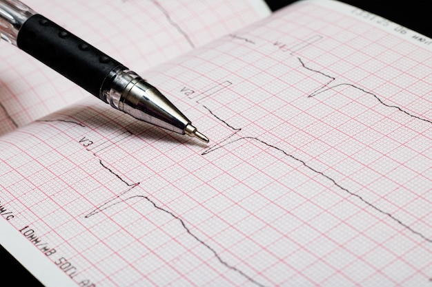 Pluma negra y línea de electrocardiograma de cerca