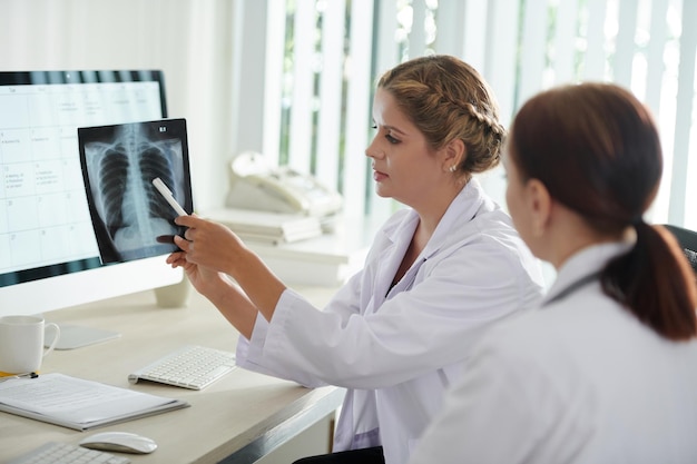 Pneumologistas discutindo raios X de pulmões