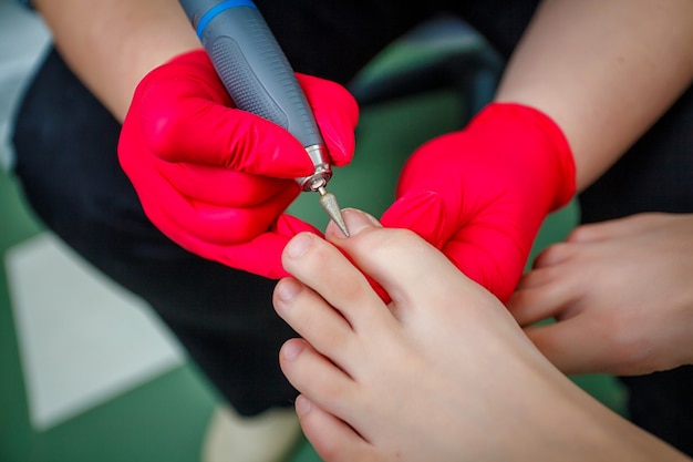 Podólogo tratante de hongos en las uñas. Tratamiento de podología.