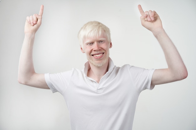 Porträt eines Albino-Mannes in einem Studio