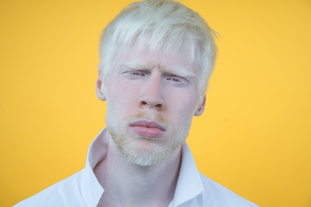 Porträt eines Albino-Mannes in einem Studio