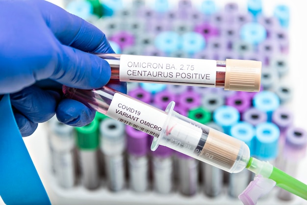 Positive Blutinfektionsprobe im Reagenzglas für CENTAURUS BA 275 omicron covid19 Coronavirus im Labor Wissenschaftler, der Patienten im Krankenhaus untersucht und analysiert