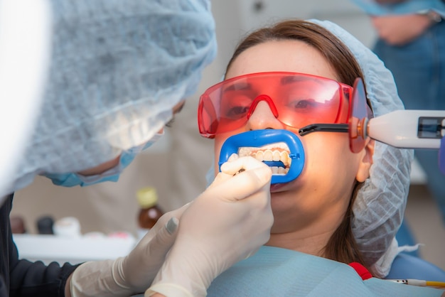 Foto preparación de la cavidad bucal para el blanqueamiento con una lámpara ultravioleta primer plano