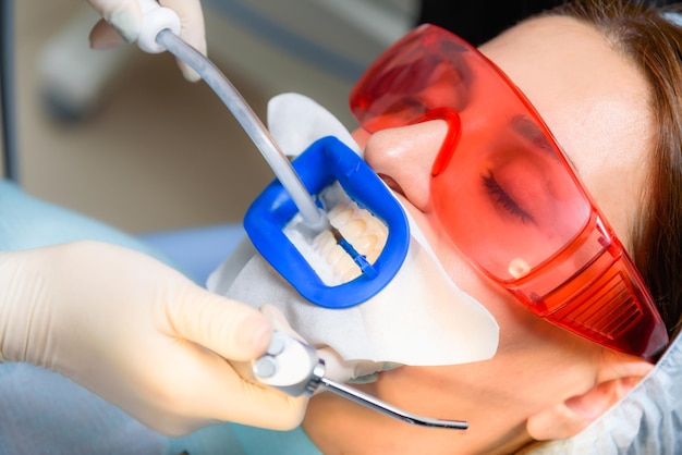 Preparando a cavidade oral para clareamento com uma lâmpada ultravioleta Closeup