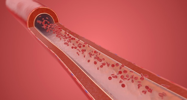 La presión arterial es la presión hacia el exterior que ejerce el flujo sanguíneo sobre las paredes de las arterias.