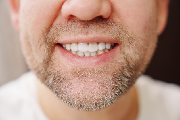 Primer plano de la boca del hombre con sonrisas de rastrojo y muestra los dientes blancos