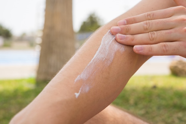 Primer plano del brazo con crema solar