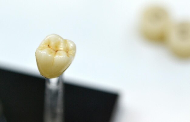 Primer plano de la corona dental