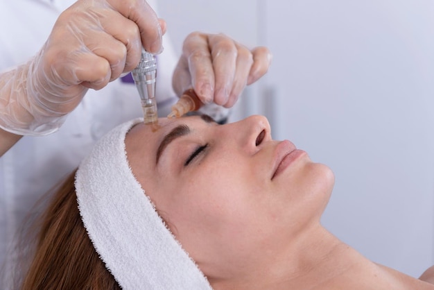 Primer plano de Cosmetologistbeautician aplicando tratamiento facial dermapen en la cara de una joven cliente en un salón de bellezaCosmetología y rejuvenecimiento facial profesional para el cuidado de la piel