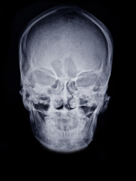 Foto un primer plano de un cráneo humano con la parte inferior visible.