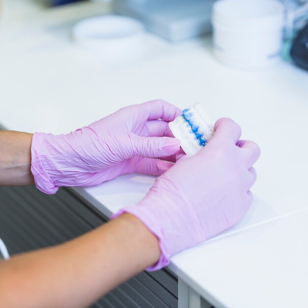 Primer plano de un dentista sosteniendo los dientes molde de yeso