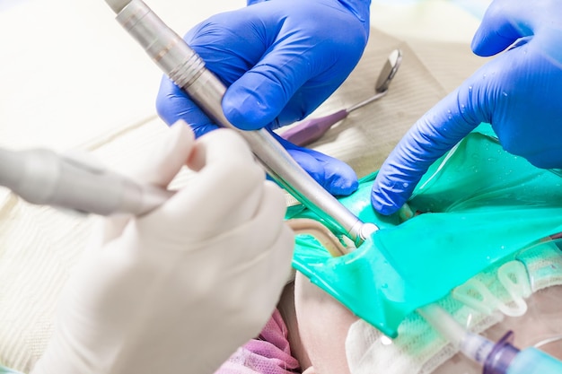 Primer plano de un dentista tratar los dientes
