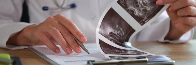 Primer plano de una doctora revisando los resultados médicos en el lugar de trabajo en la lectura de la enfermera de la clínica