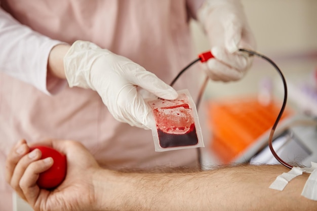 Primer plano de la enfermera ajustando la bolsa de sangre del donante masculino en el centro de donación de sangre o en el espacio de copia del hospital