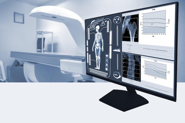 El primer plano de la foto borrosa abstracta examina las imágenes de densidad ósea de todo el cuerpo del paciente durante un control de salud y una consultaImagen de enfoque selectivo