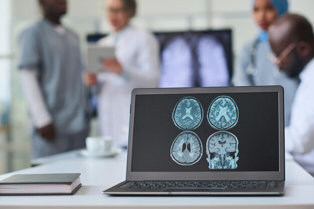 Primer plano de la imagen de rayos X del cerebro en el monitor de la computadora portátil con un grupo de médicos que trabajan en segundo plano.