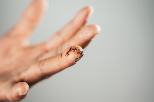 Foto primer plano de un insecto en la mano