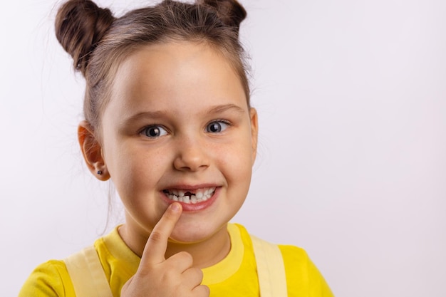 Primer plano de una joven con la boca abierta apuntando al diente frontal faltante con el dedo sonriendo sobre fondo blanco Primeros dientes cambiando ir al dentista para hacer el tratamiento dental