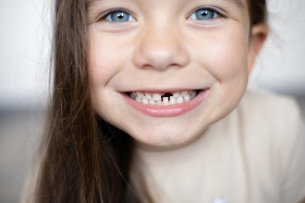 Primer plano Una linda chica divertida de ojos azules sin un diente de leche Una sonrisa sin dientes Un diente de leche se cayó Enfoque selectivo