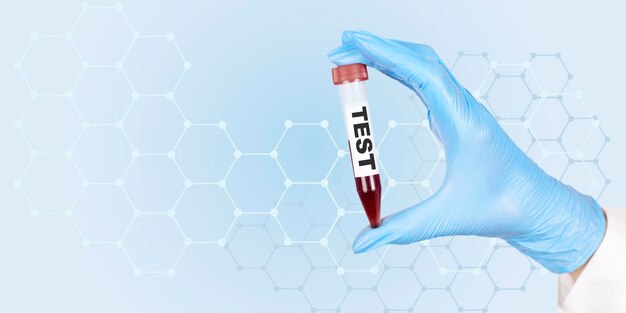 Primer plano de la mano de una doctora en guantes médicos sosteniendo un tubo de ensayo, vacutainer, con sangre roja para la prueba en un laboratorio de hematología. Copie el espacio. foto de alta calidad