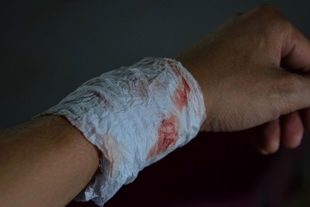 Foto primer plano de una mano herida cortada con venda adhesiva
