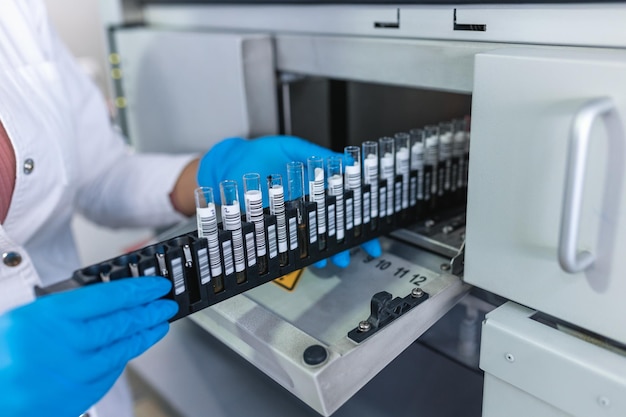 Primer plano de la mano de un médico mirando el tubo de ensayo de muestra de sangre en una máquina Captura recortada de manos científicas irreconocibles con guantes protectores que trabajan en un laboratorio de pruebas