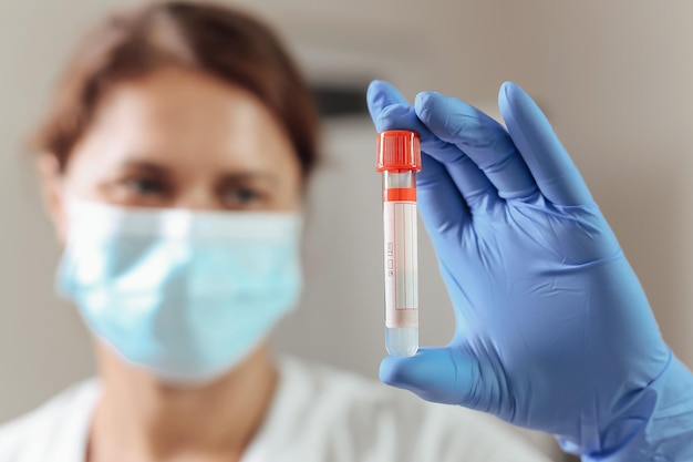 Primer plano de la mano de un médico con un tubo de análisis de sangre en un laboratorio