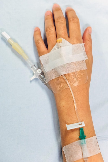 Foto primer plano de la mano de una mujer con equipo médico en la cama