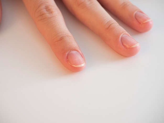 Primer plano de la mano de una mujer, con esmalte de uñas transparente aplicado. Protección y cuidado de uñas. manicura.