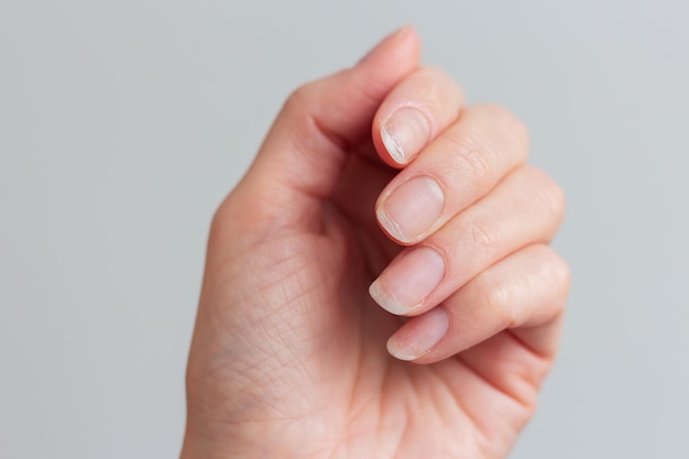 Primer plano de la mano de una mujer mostrando sus dedos y uñas