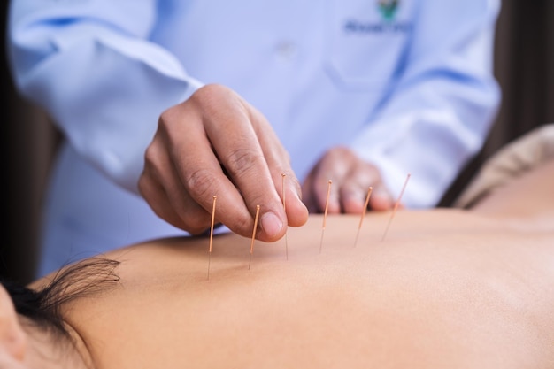 Primer plano de una mano sosteniendo una aguja de acupuntura en la piel