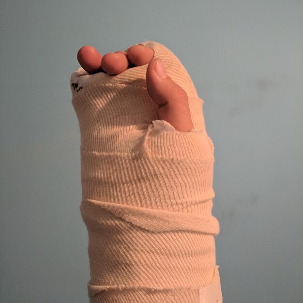 Primer plano de la mano con vendaje