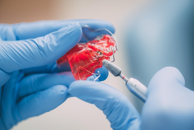 Primer plano de las manos de un dentista haciendo corrección en dentadura postiza móvil.