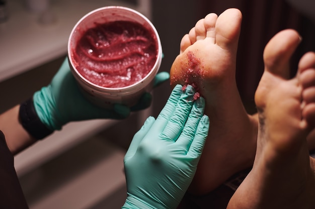 Foto primer plano de las manos de la esteticista sosteniendo una botella con exfoliante para pies y aplicándola en los pies de la mujer en el salón de belleza