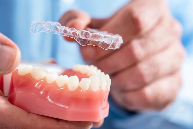 Primer plano El médico pone alineadores transparentes en los dientes de la mandíbula artificial