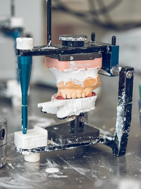 Primer plano de moldes de yeso colocados en el articulador mientras se prepara para crear una dentadura postiza en un laboratorio dental profesional