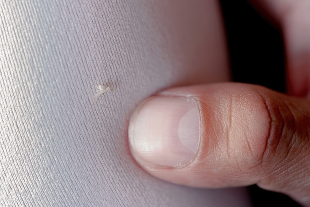 Primer plano muy diminuta araña blanca sobre fibra de tela con el dedo del hombre, pequeño insecto vivo en una camisa humana