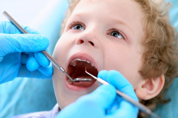 Un primer plano de un niño al que un dentista le examinó los dientes.