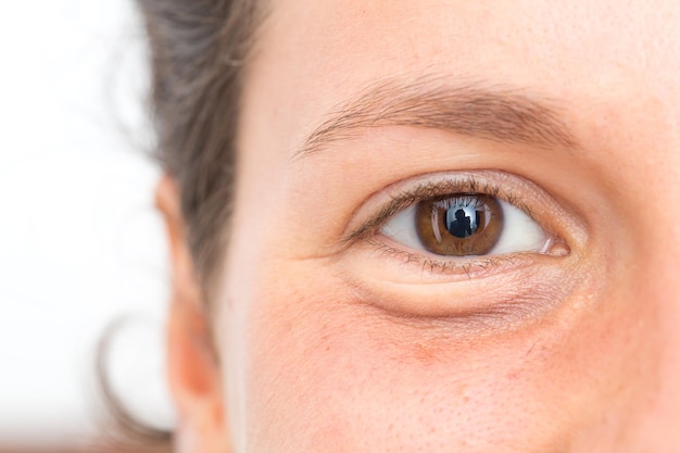 Primer plano del ojo hinchado de la hembra que causa la bolsa del ojo aislada sobre fondo blanco