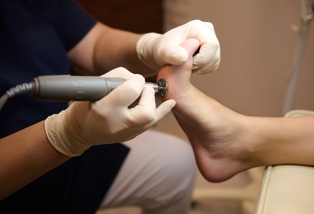 Primer plano de un paciente que visita al podólogo, en el procedimiento de pedicura médica, recibiendo el procedimiento de pelado de hardware con una máquina eléctrica