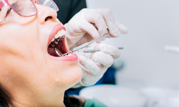 Primer plano del paciente revisado por el dentista Dentista revisando la boca del paciente Cerca de las manos del dentista revisando la boca del paciente Dentista realizando estomatología