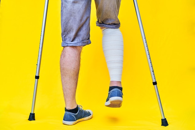 Foto primer plano de las piernas de un hombre por detrás con pantalones cortos y muletas, con una pierna vendada