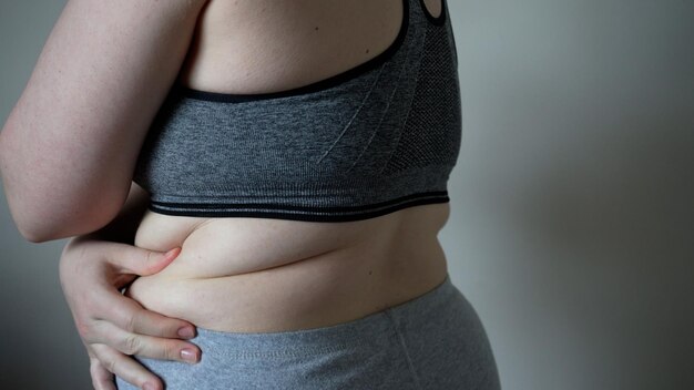 Primer plano de pliegues de grasa en el vientre grande de una mujer con sobrepeso Concepto de dieta de obesidad femenina con sobrepeso y problemas de sobrepeso