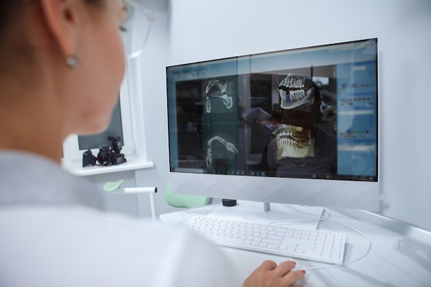 Foto primer plano recortado de dentista examina escaneos de rayos x dentales en una computadora