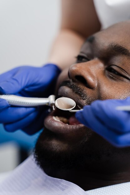 Primer plano de taladro dental Dentista perforando dientes de hombre africano en clínica de odontología Tratamiento de dientes Relleno dental para paciente hombre afroamericano