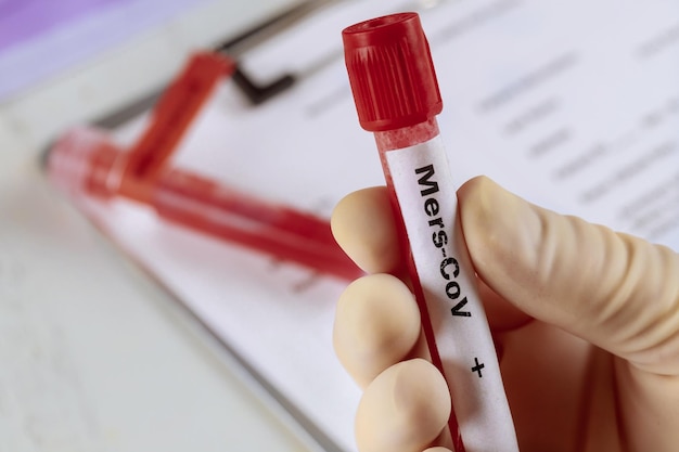 Foto primer plano del texto en la mano sobre un tubo de ensayo con una muestra de sangre