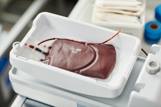 Primer plano de la vista superior de la bolsa de sangre llena en la bandeja en el espacio de copia del centro de donación de sangre