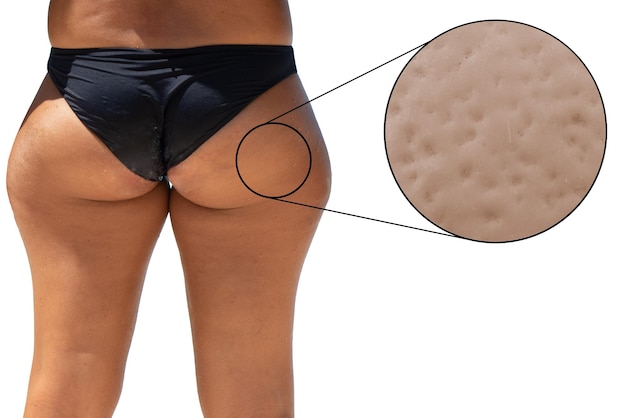 Un primer plano y una vista trasera de las nalgas y las piernas de una mujer con un bikini negro